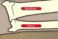 Radius & Ulna Bones