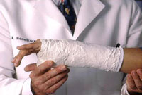 Casting of Scaphoid Fracture