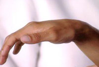 Lateral Range of Motion